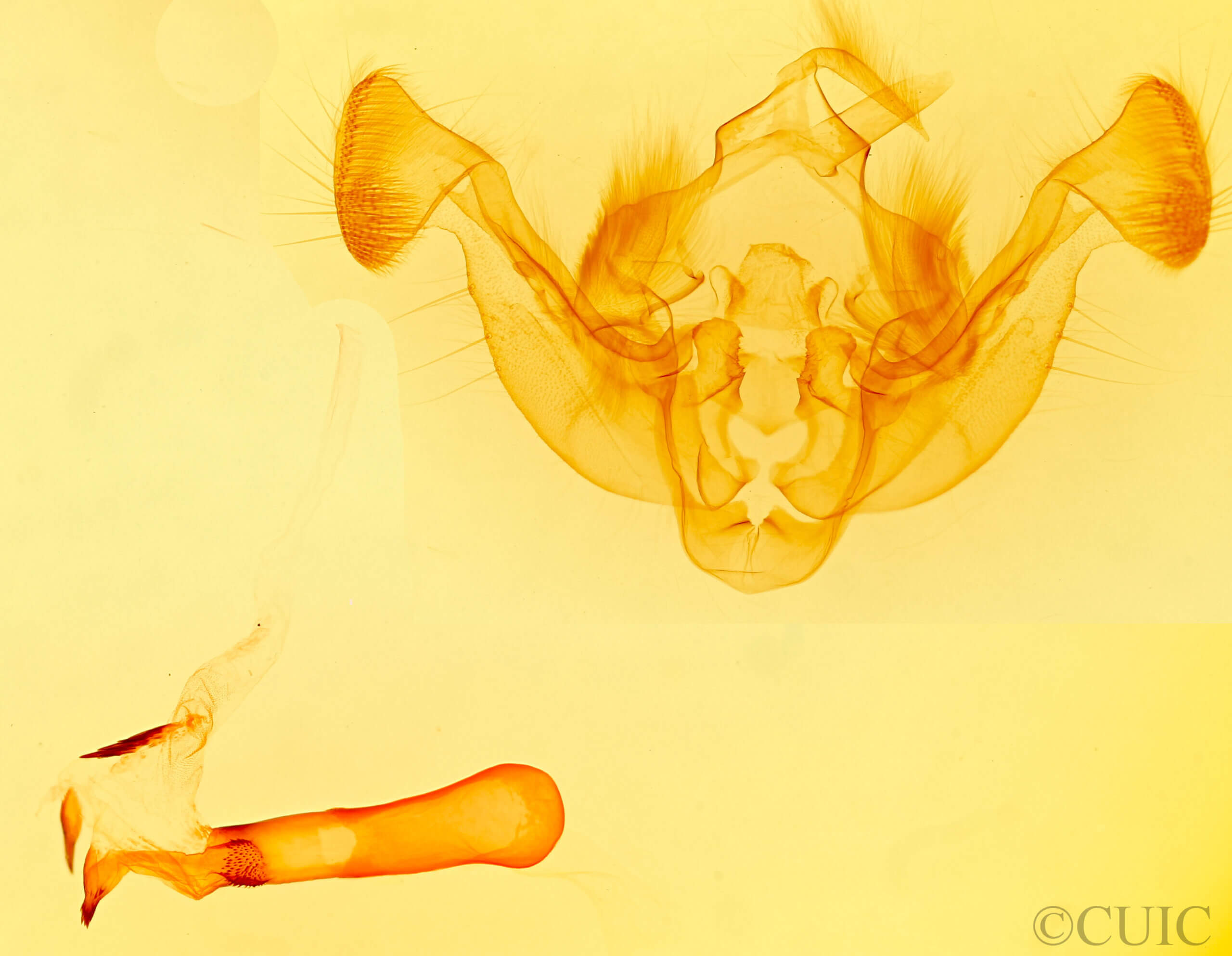 genitalia view of adult Resapamea passer