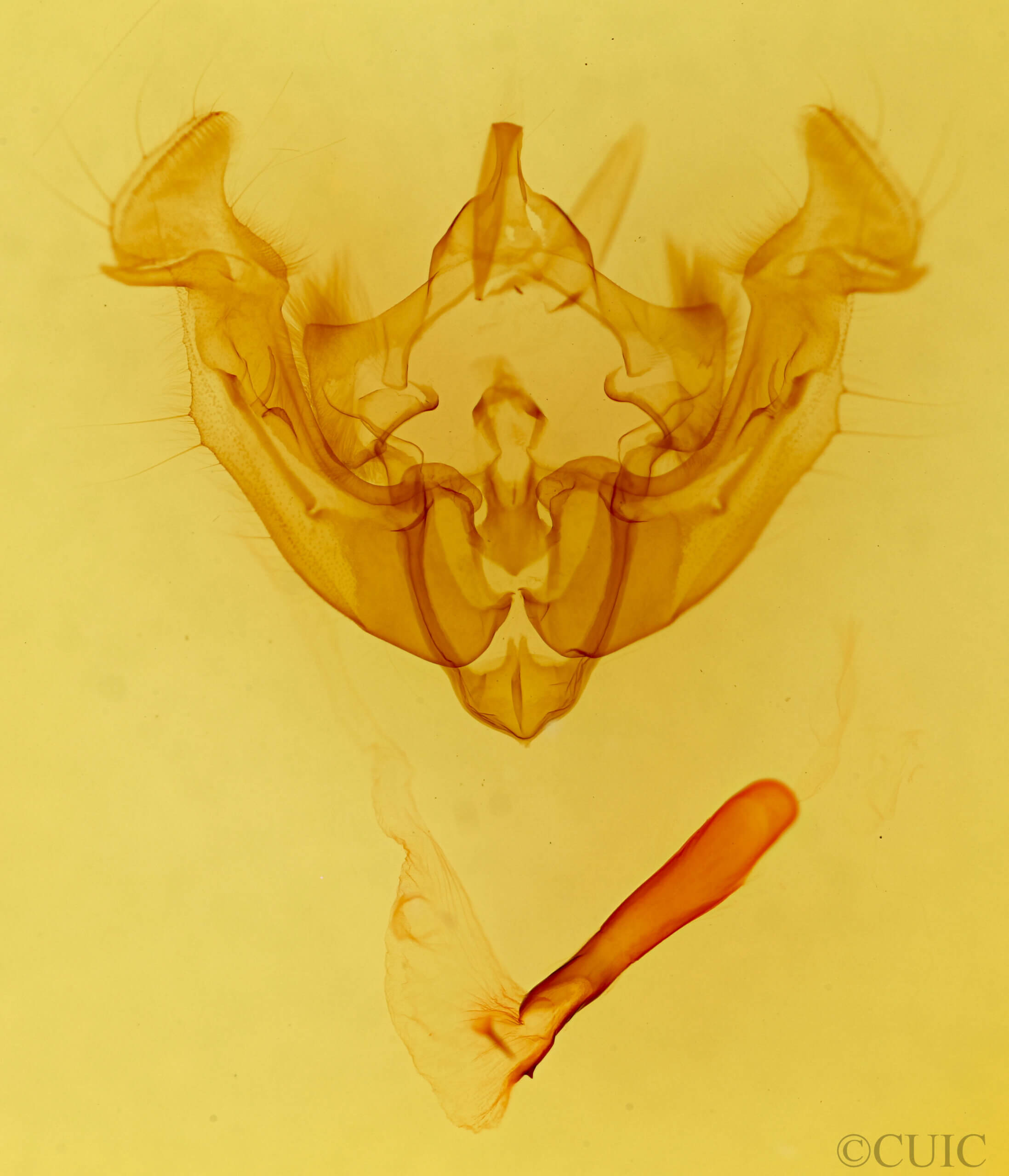 genitalia view of adult Apamea inficita