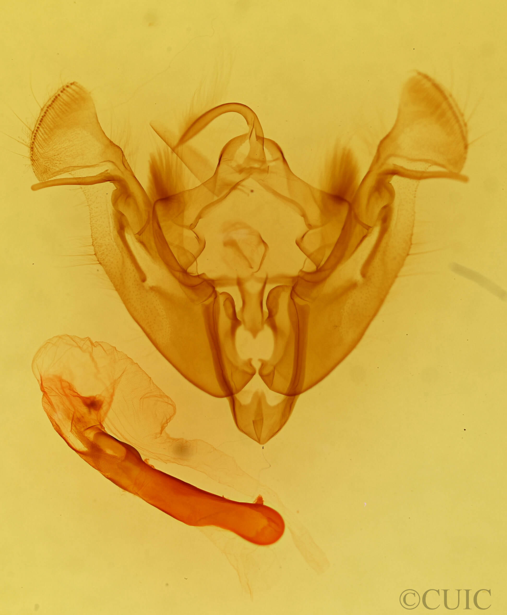 genitalia view of adult Apamea burgessi