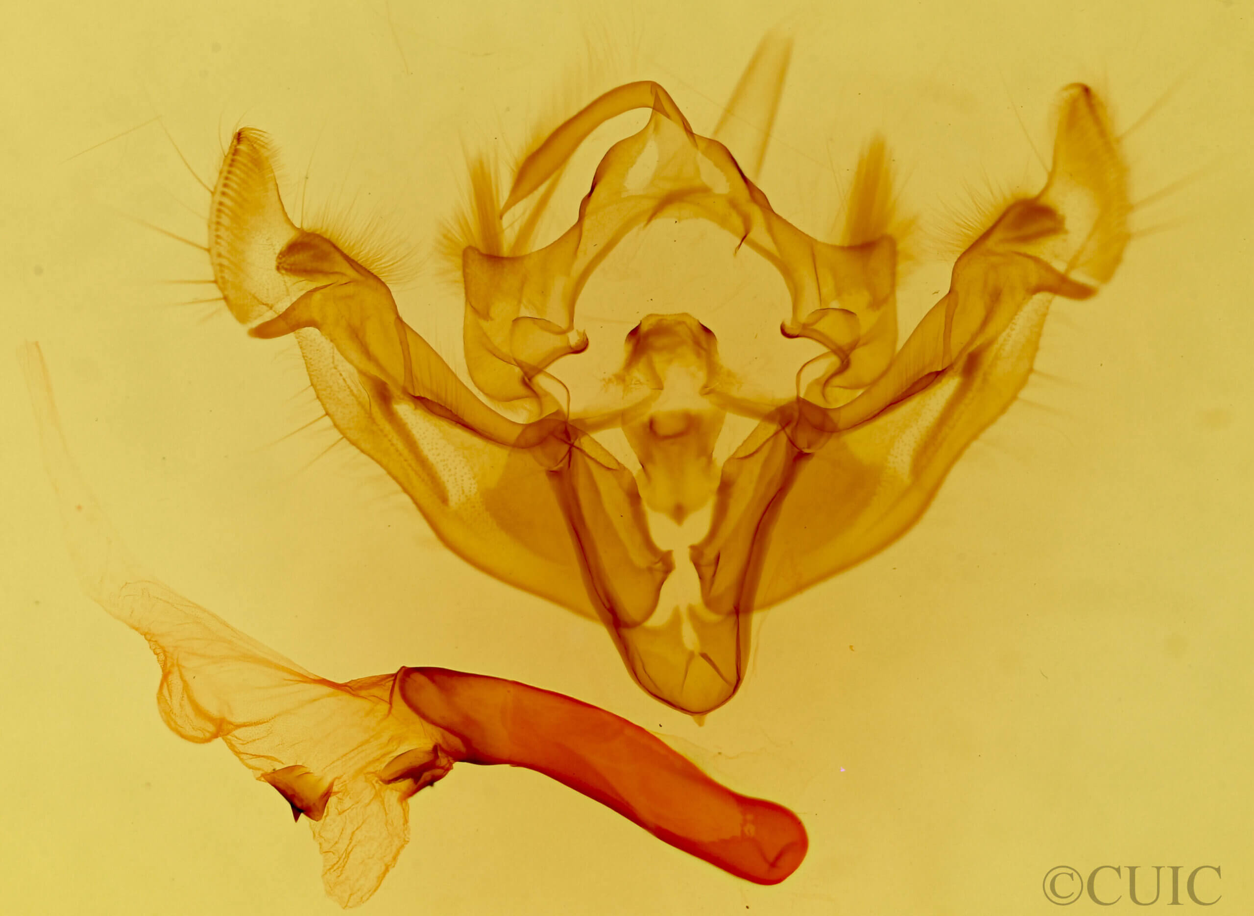 genitalia view of adult Apamea niveivenosa