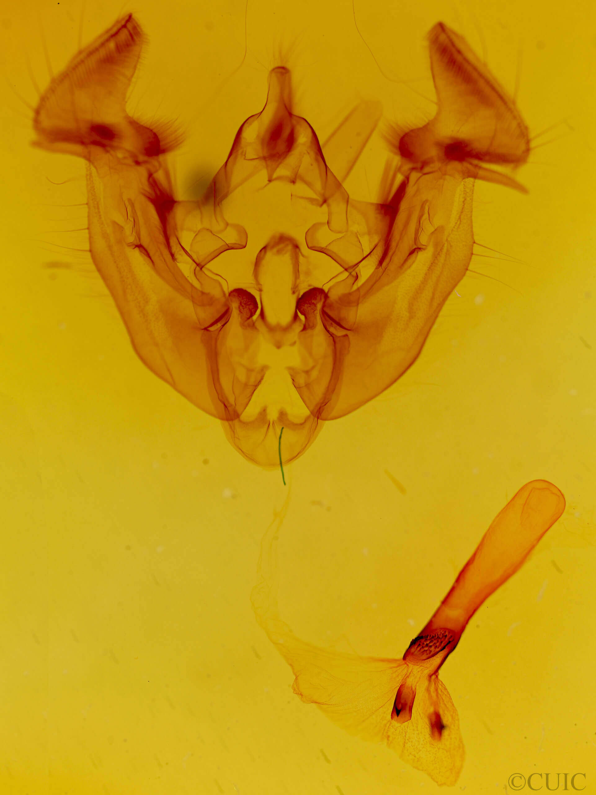 genitalia view of adult Apamea contradicta