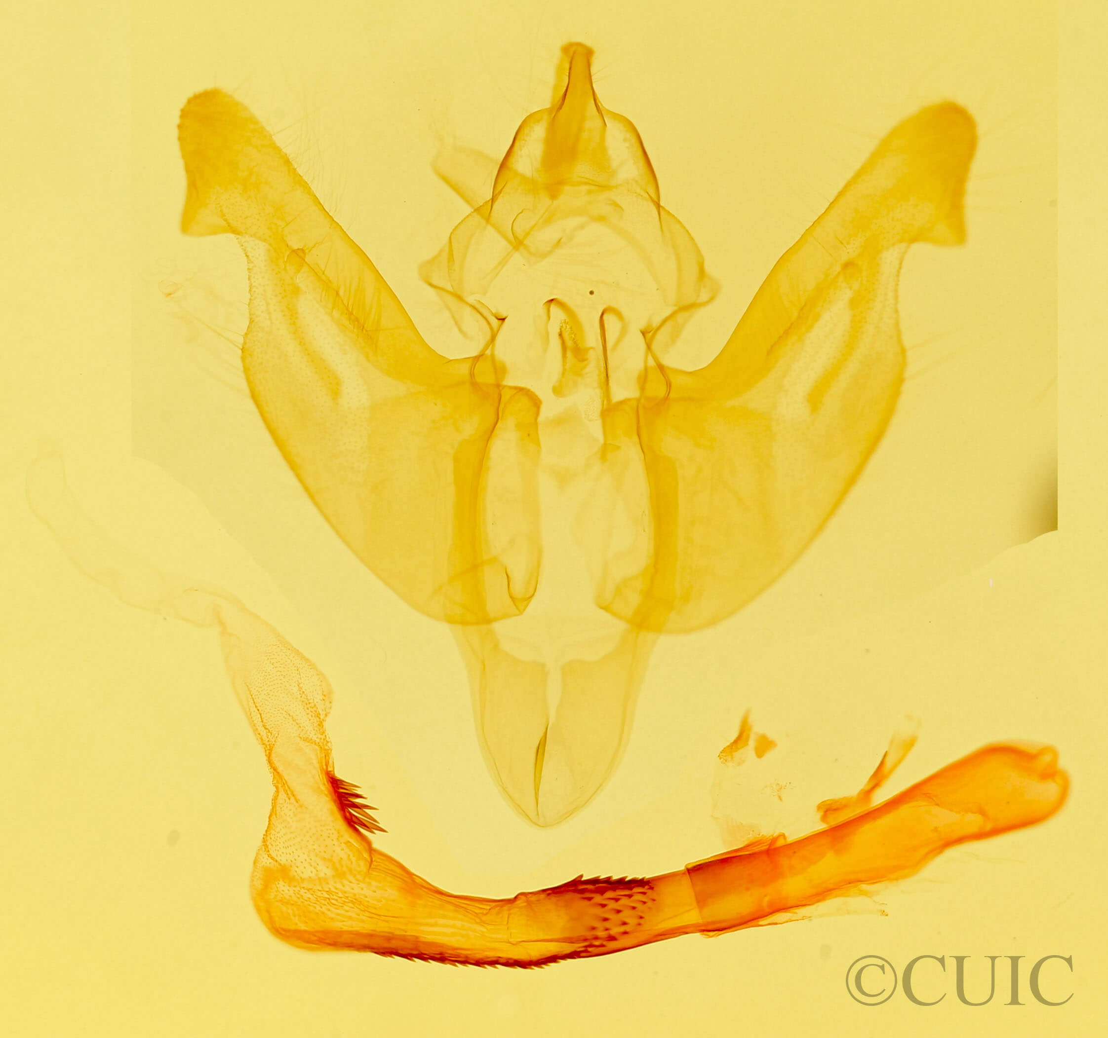 genitalia view of adult Luperina testacea