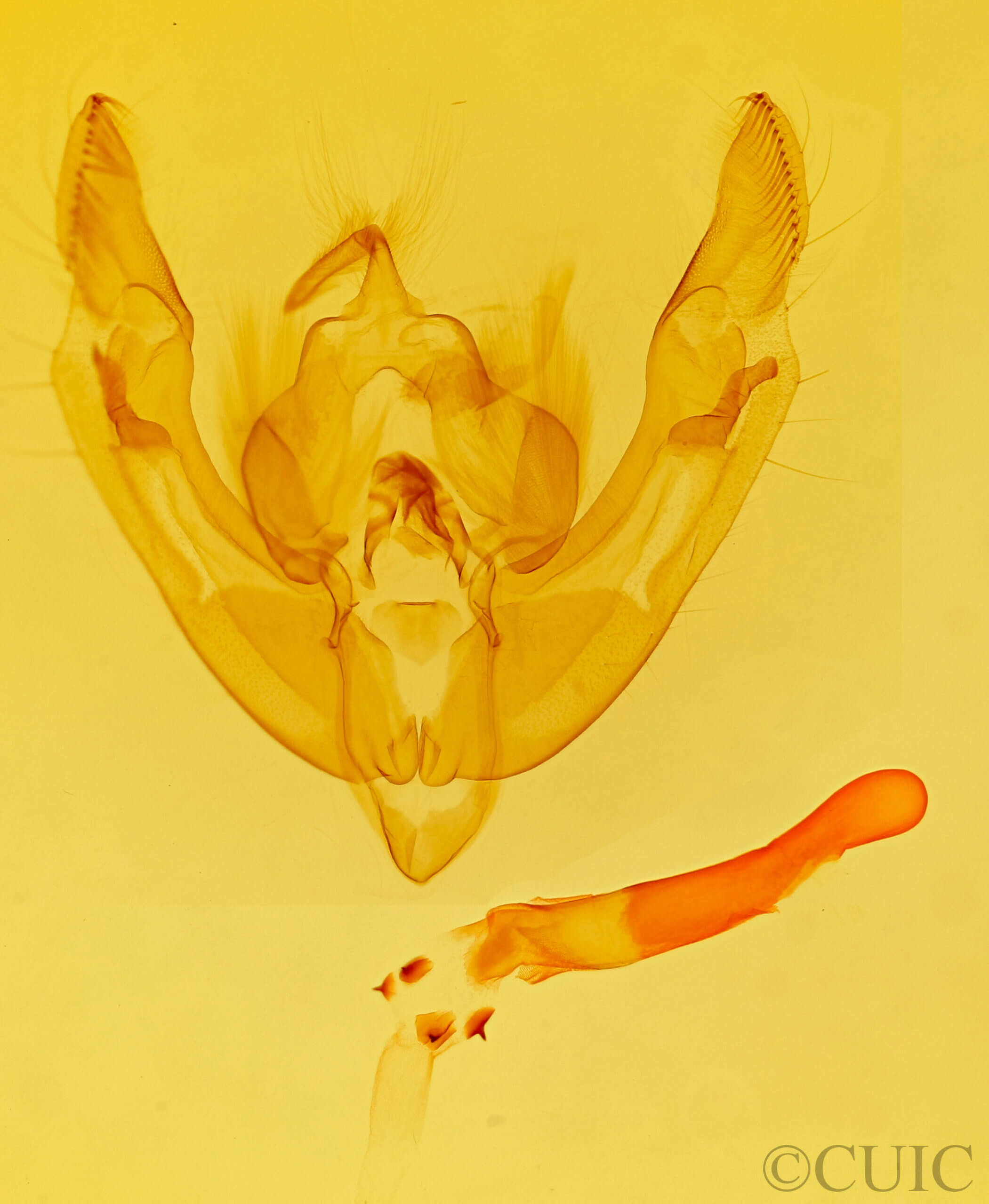 genitalia view of adult Ipimorpha pleonectusa