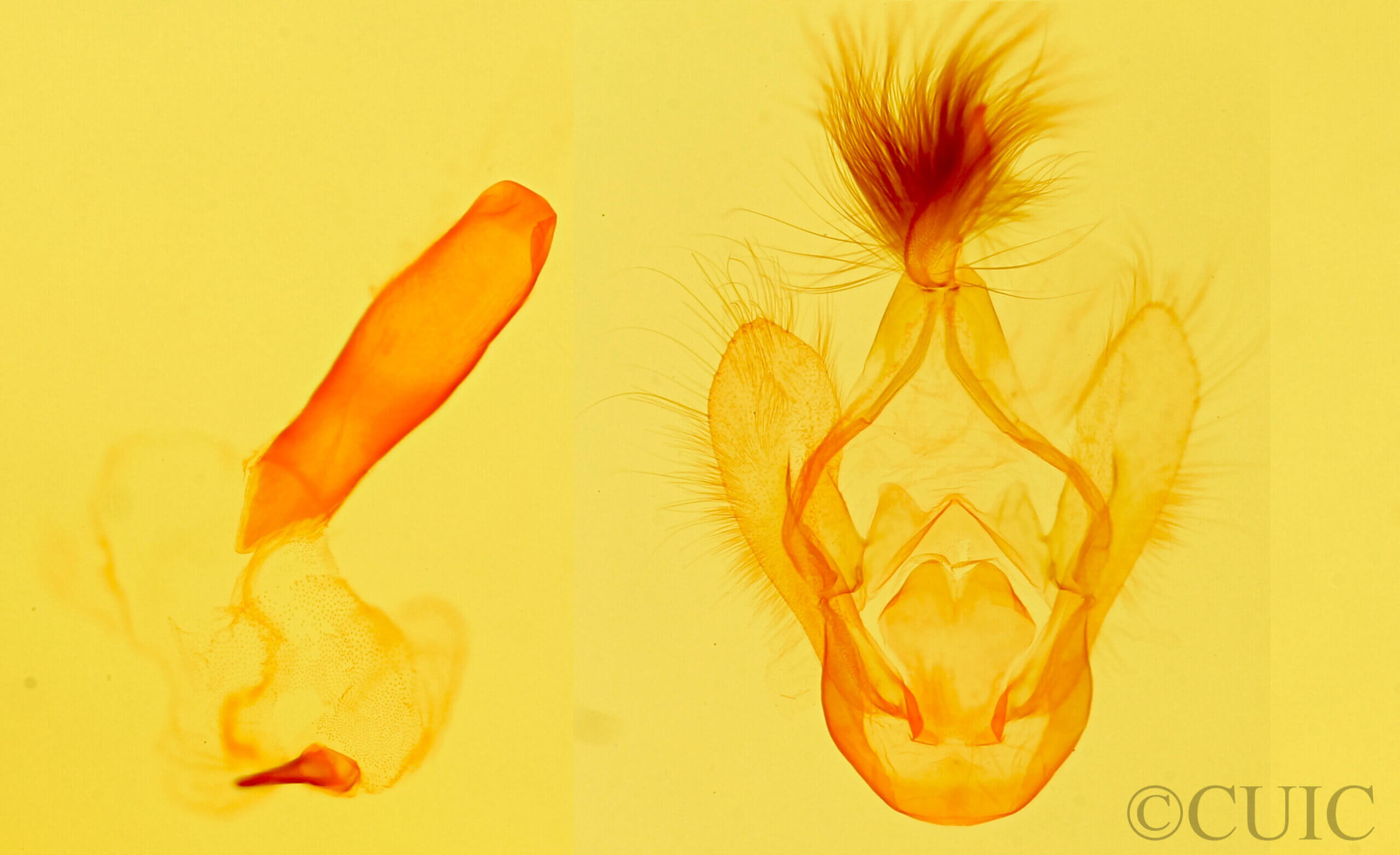 genitalia view of adult Azeta sp.
