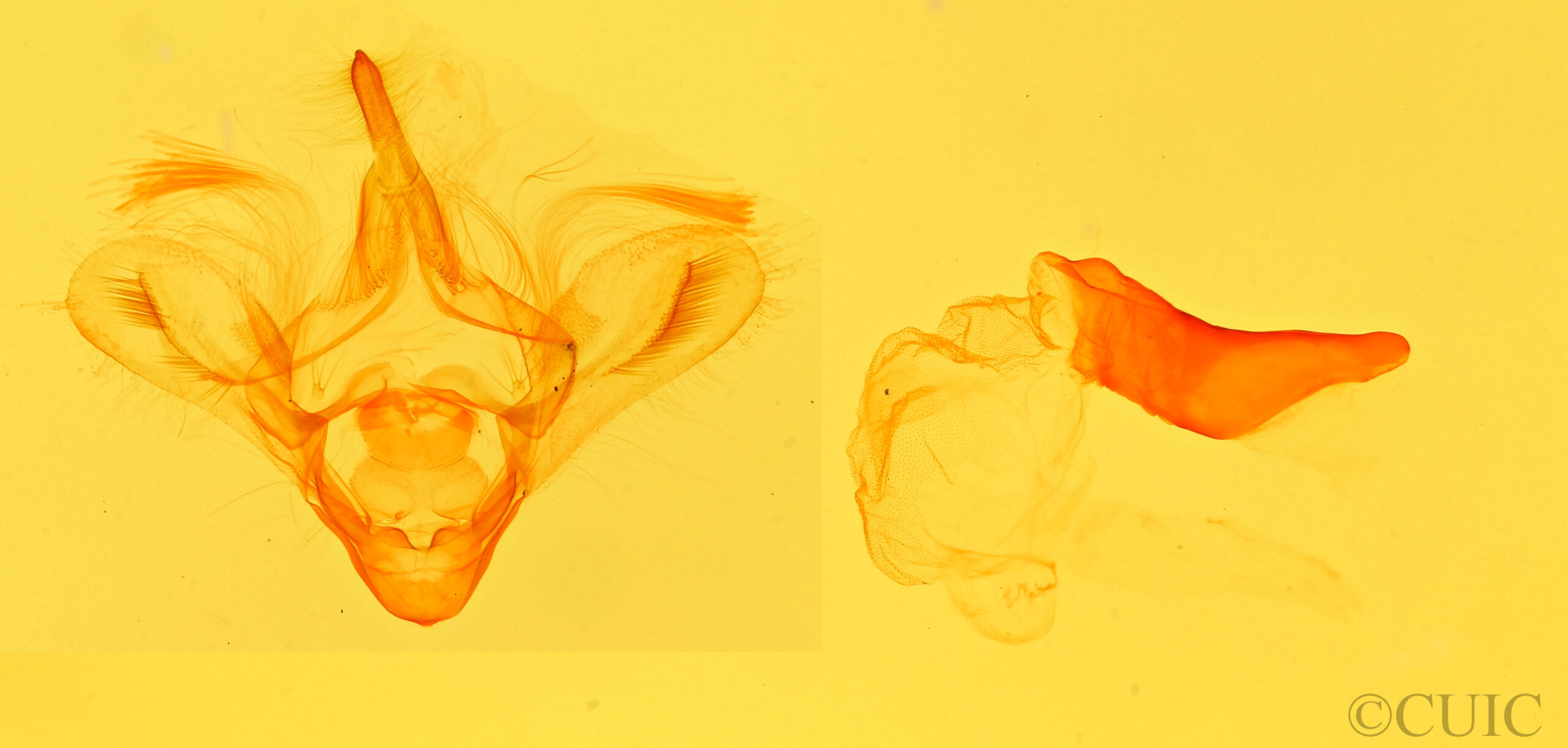 genitalia view of adult Anticarsia sp.