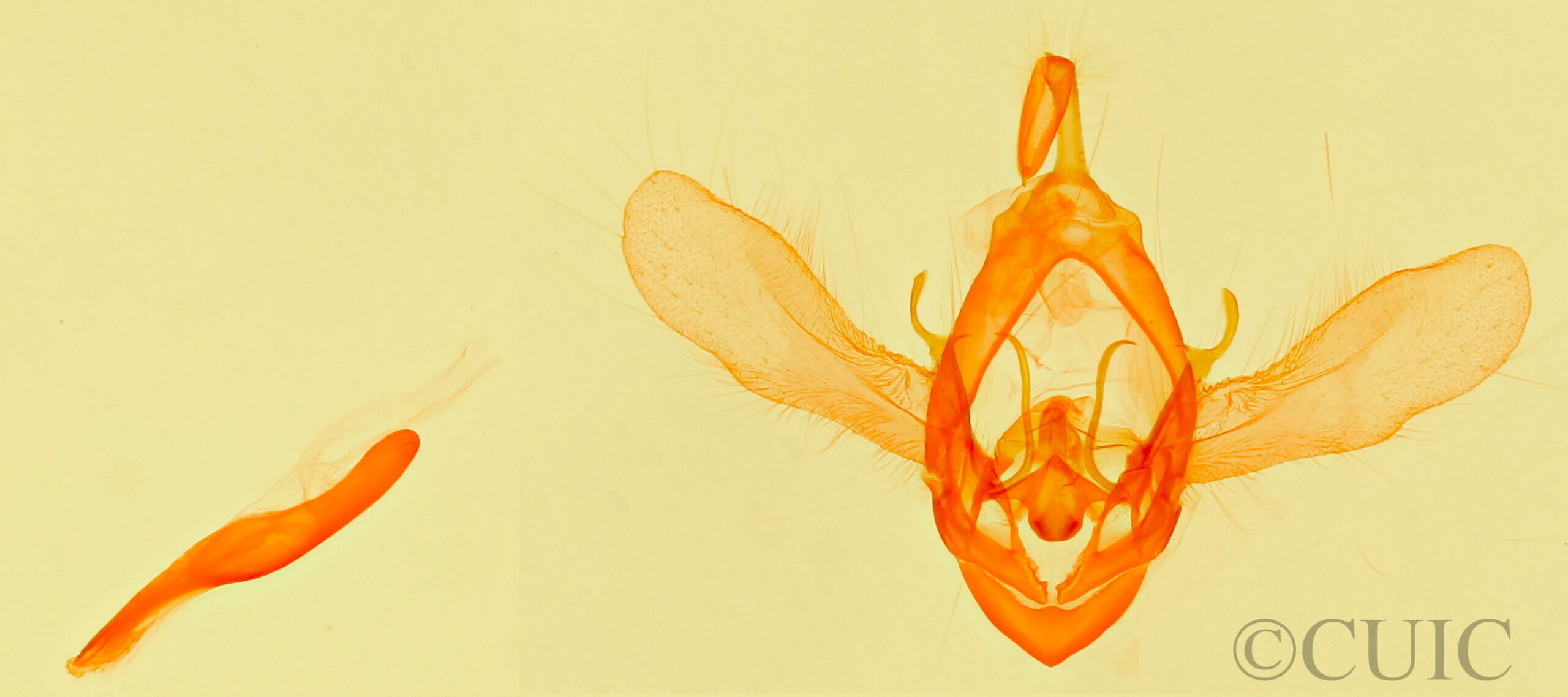 genitalia view of adult Metallata absumens