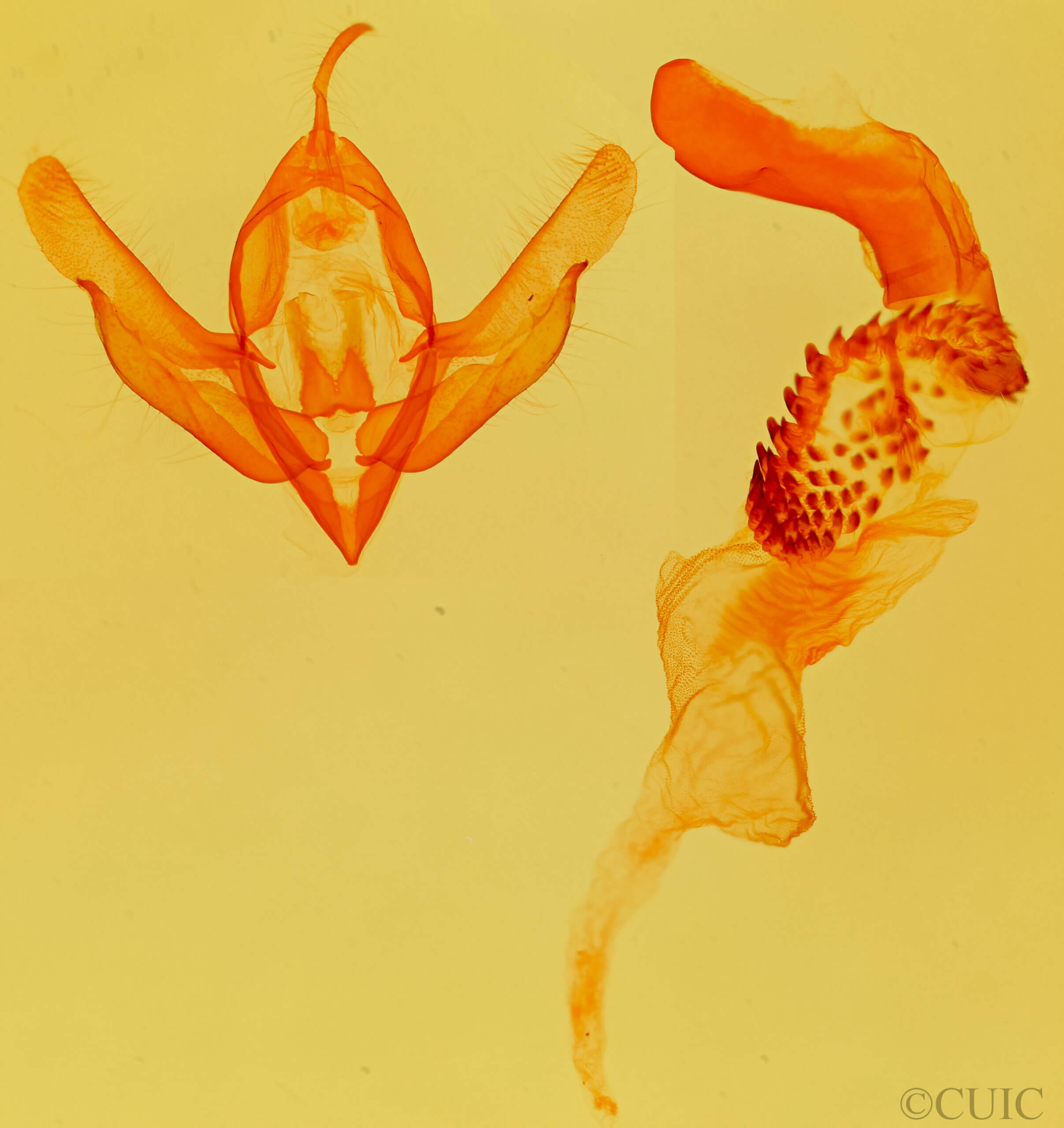 genitalia view of adult Acronicta americana