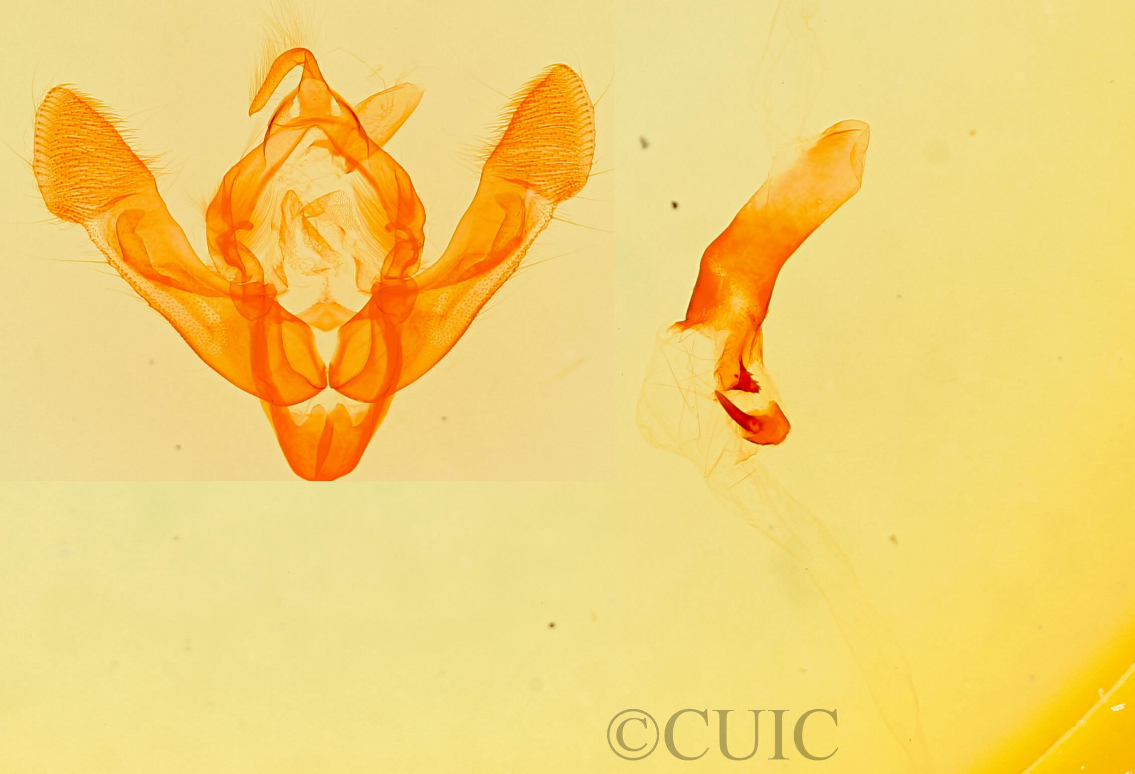 genitalia view of adult Platypolia mactata