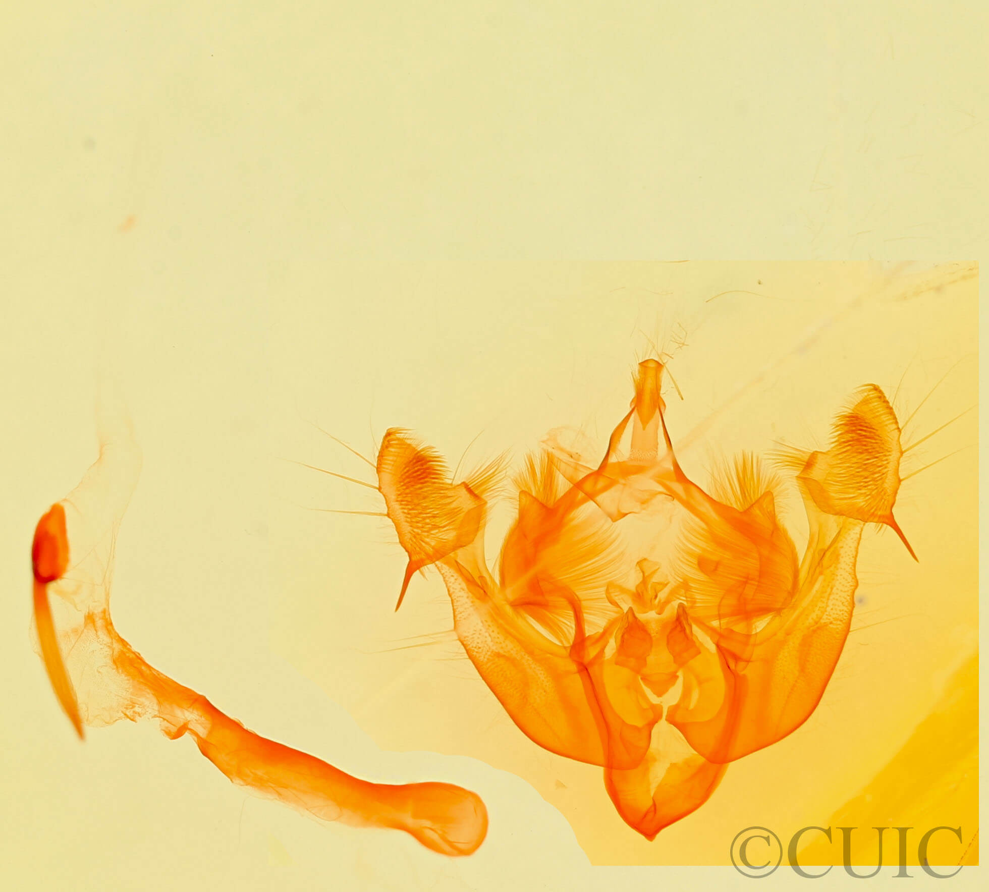 genitalia view of adult Oligia miniscula