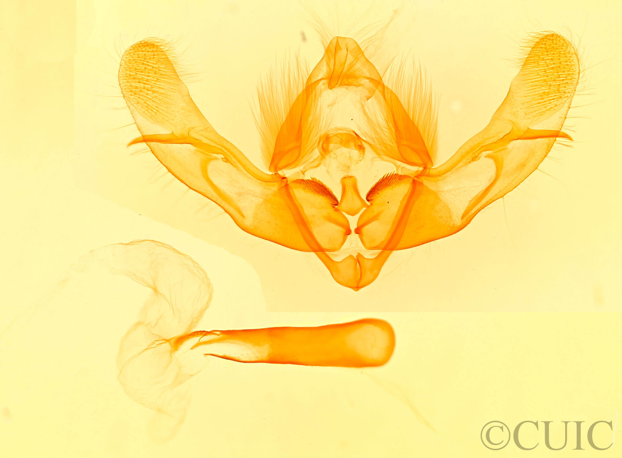 genitalia view of adult Oligia chlorostigma