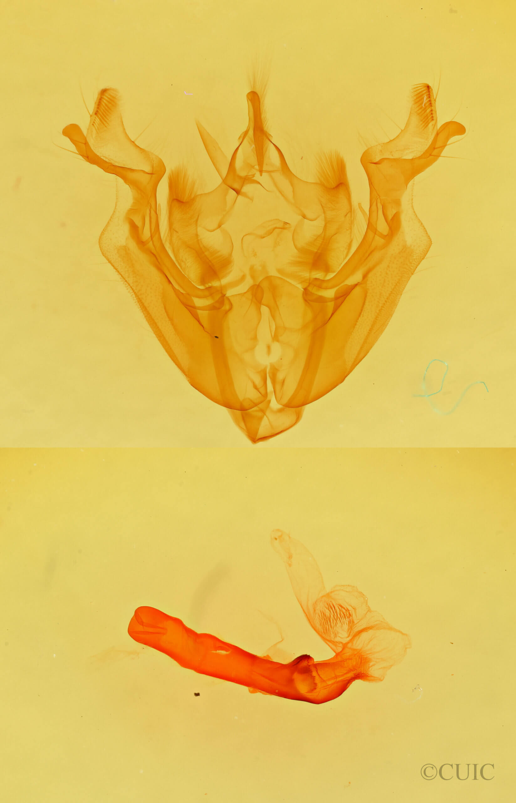 genitalia view of adult Loscopia velata