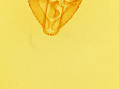 genitalia view of adult Zale exhausta