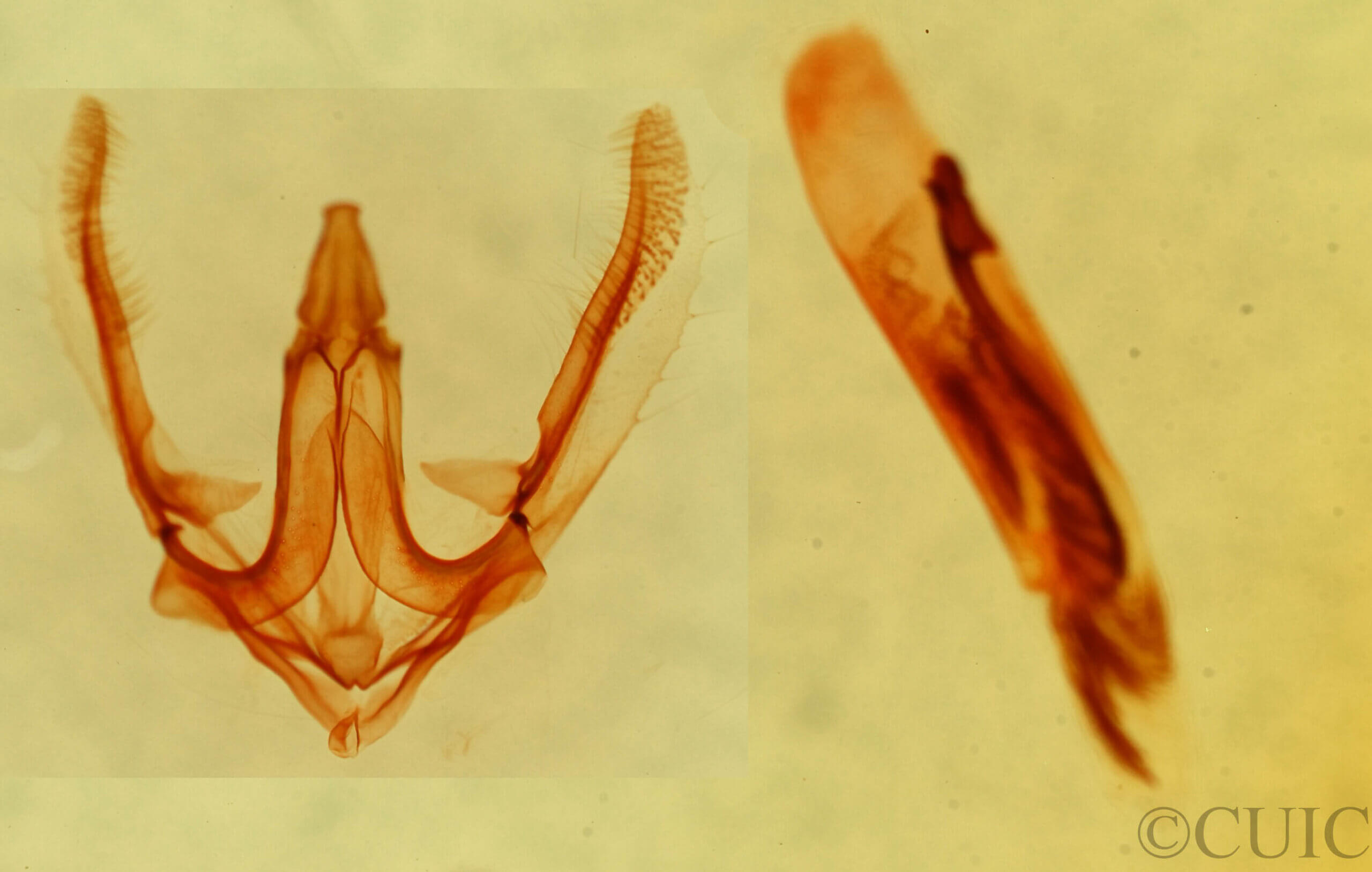 genitalia view of adult Anavitrinella addendaria