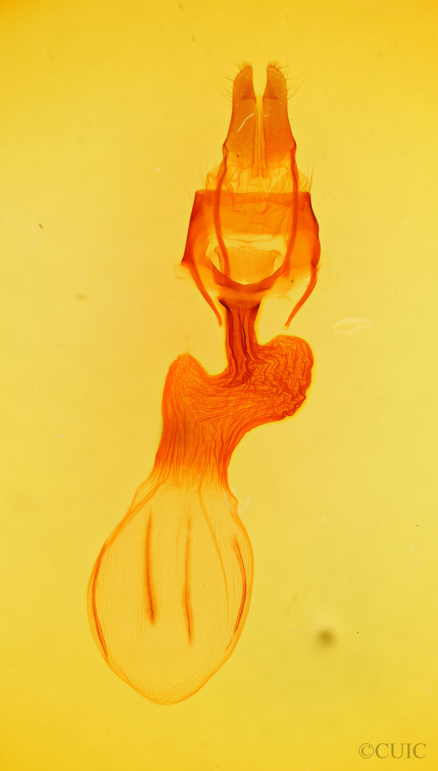 genitalia view of adult Apamea dubitans