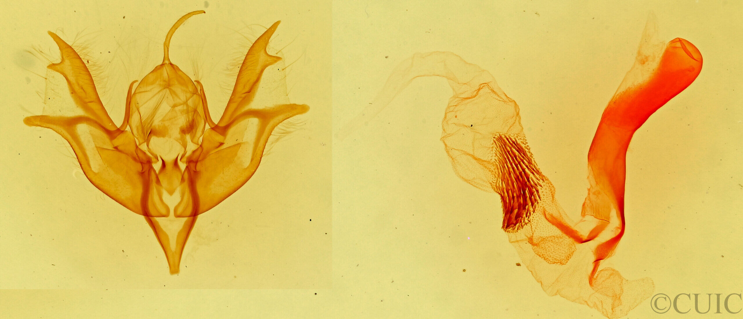 genitalia view of adult Caradrina meralis