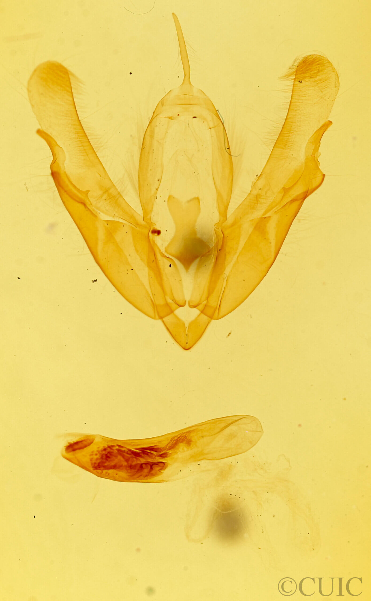 genitalia view of adult Acronicta interrupta