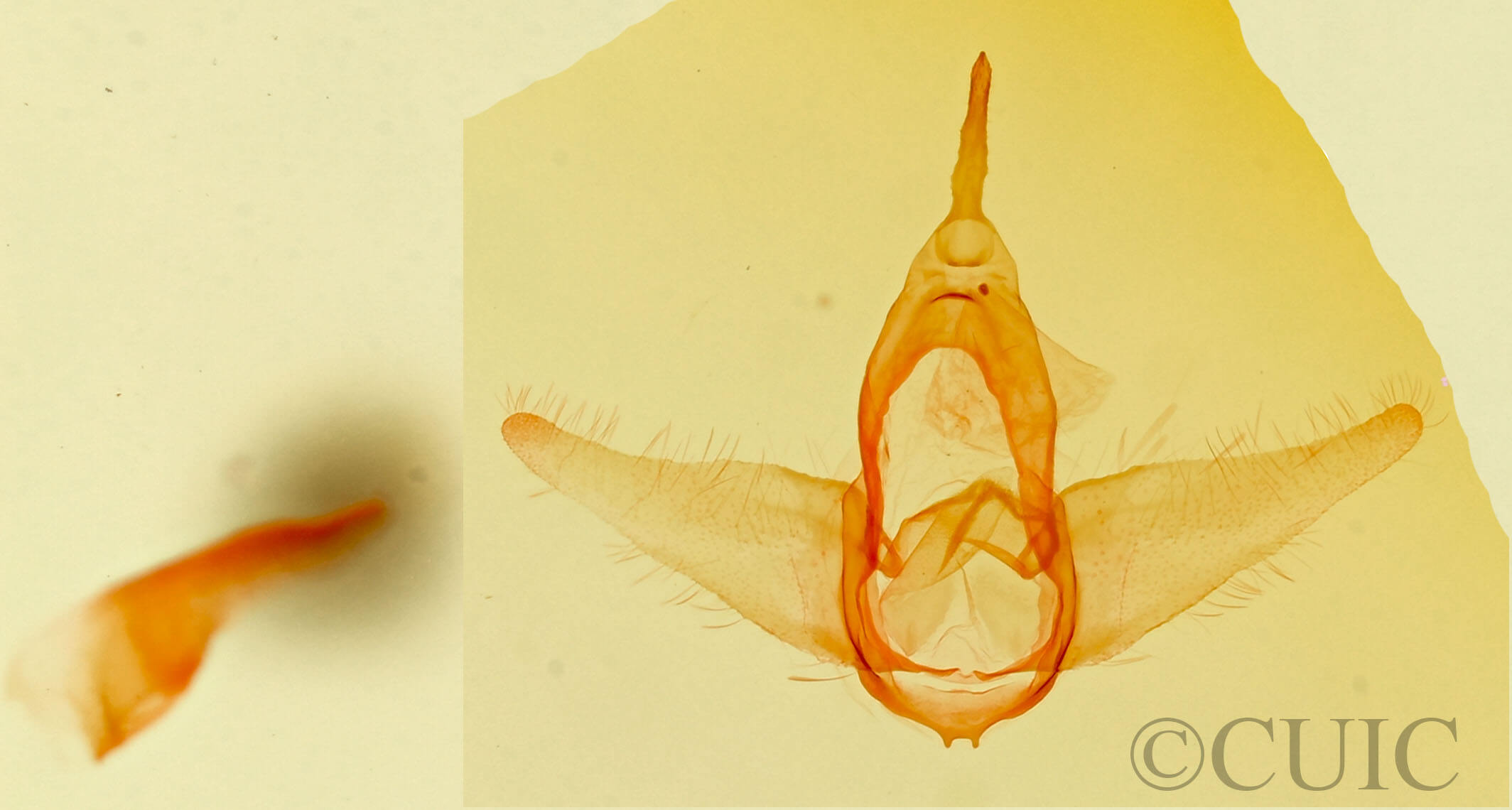 genitalia view of adult Prosoparia perfuscaria