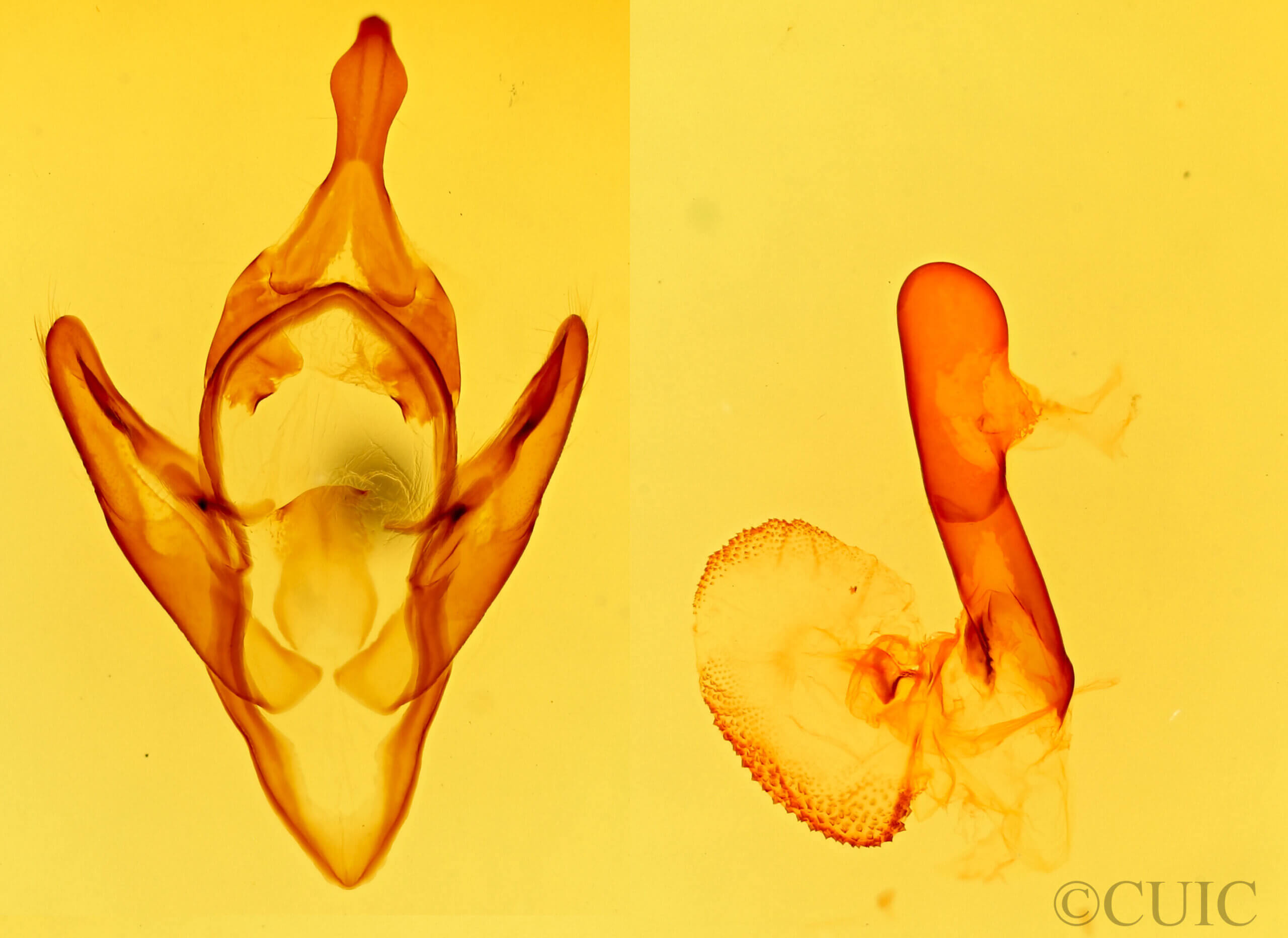 genitalia view of adult Apantesis proxima