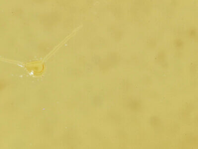 genitalia view of adult Cosmia sp.