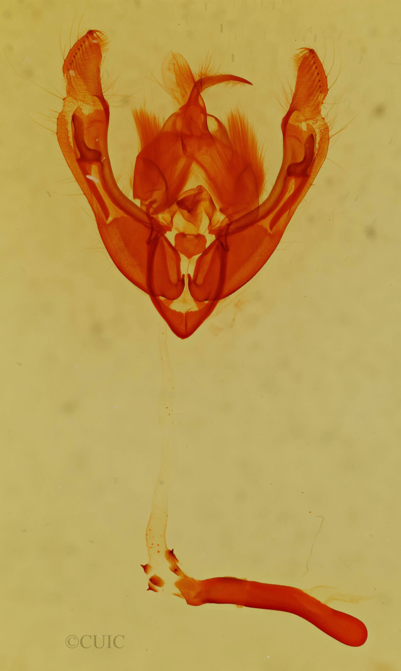 genitalia view of adult Ipimorpha sp.