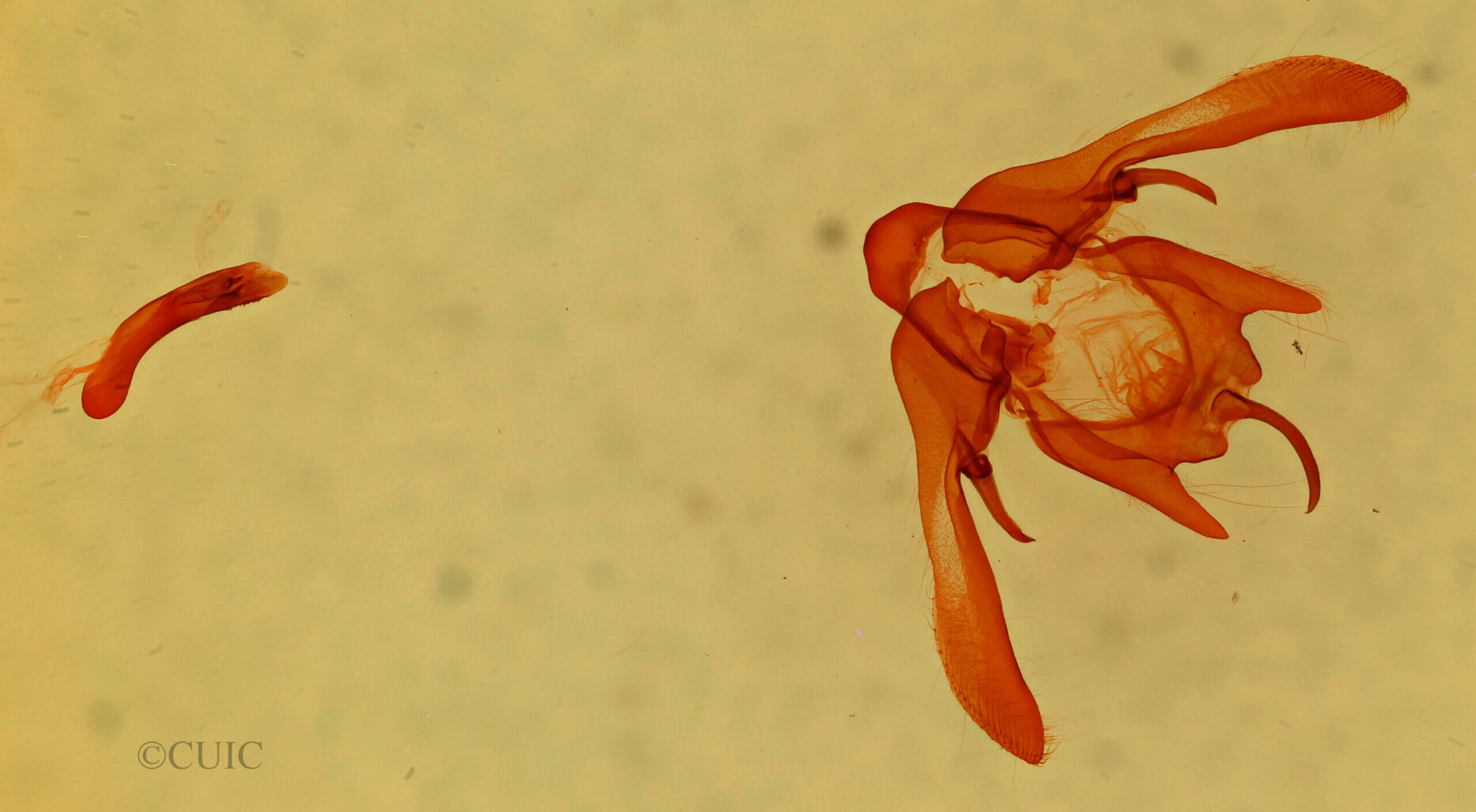 genitalia view of adult Enargia sp.