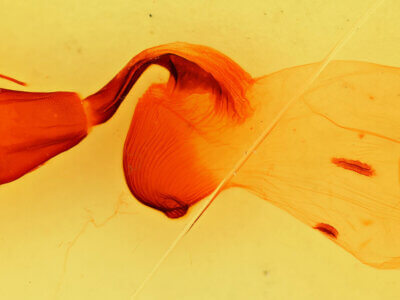 genitalia view of adult Fishia sp.