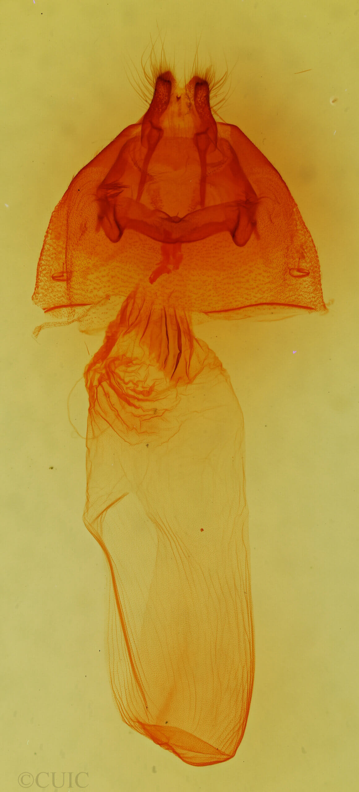 genitalia view of adult Dolocucullia dentilinea?