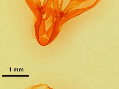 genitalia view of adult Drasteria pallescens