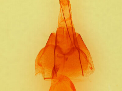 genitalia view of adult Drasteria pallescens