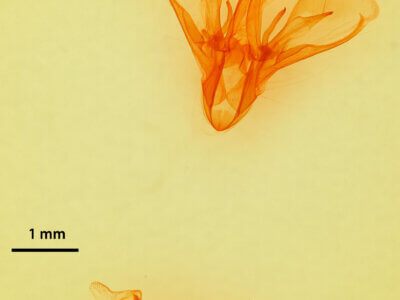 genitalia view of adult Drasteria pallescens