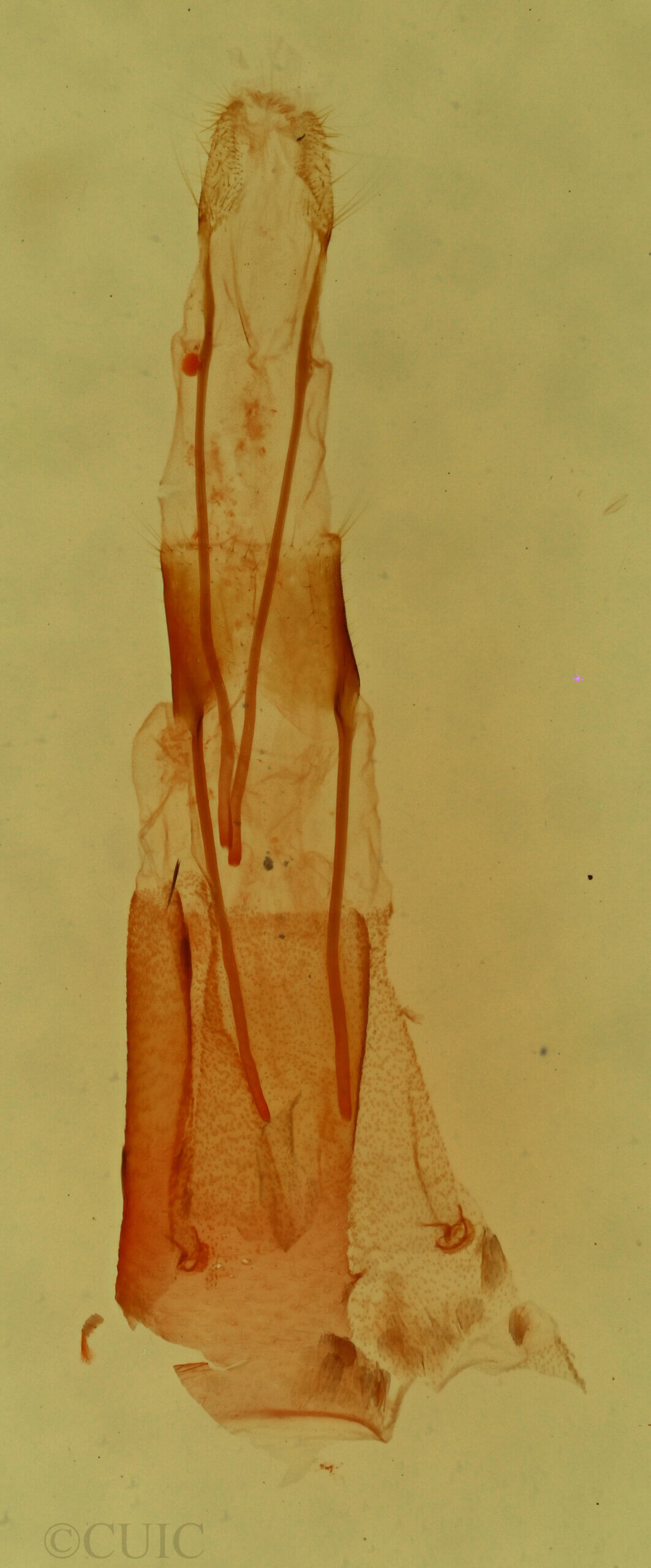genitalia view of adult Fotella sp.