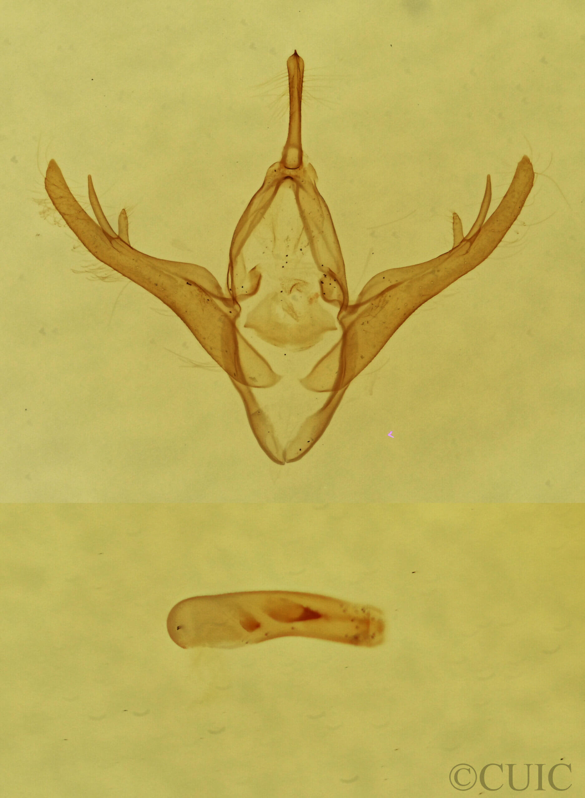 genitalia view of adult Gabara sp.