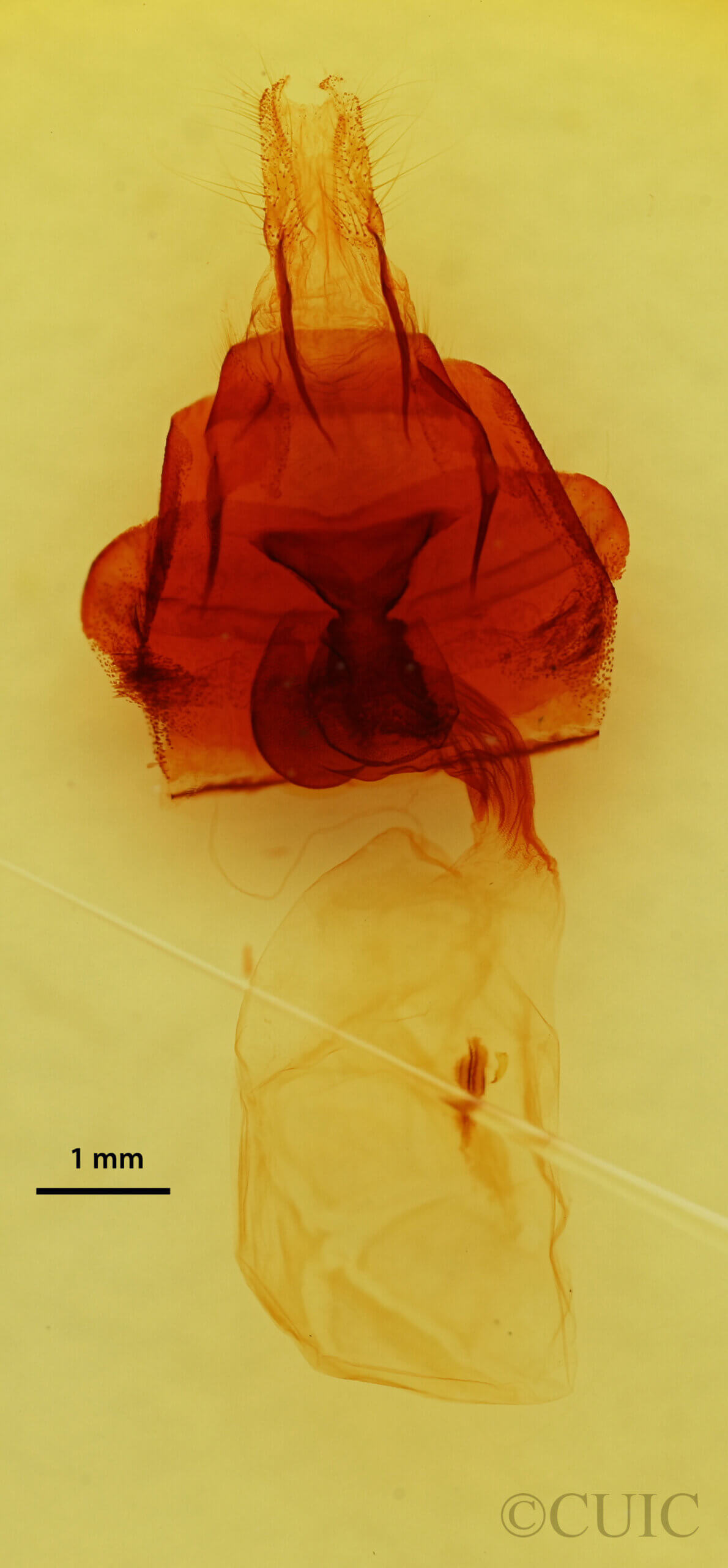 genitalia view of adult Platypolia anceps