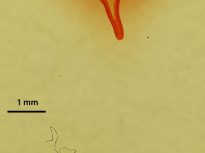 genitalia view of adult Stretchia sp.
