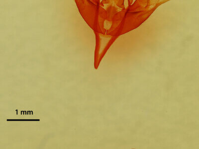 genitalia view of adult Stretchia sp.