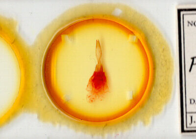 slide view of adult Protorthodes sp.