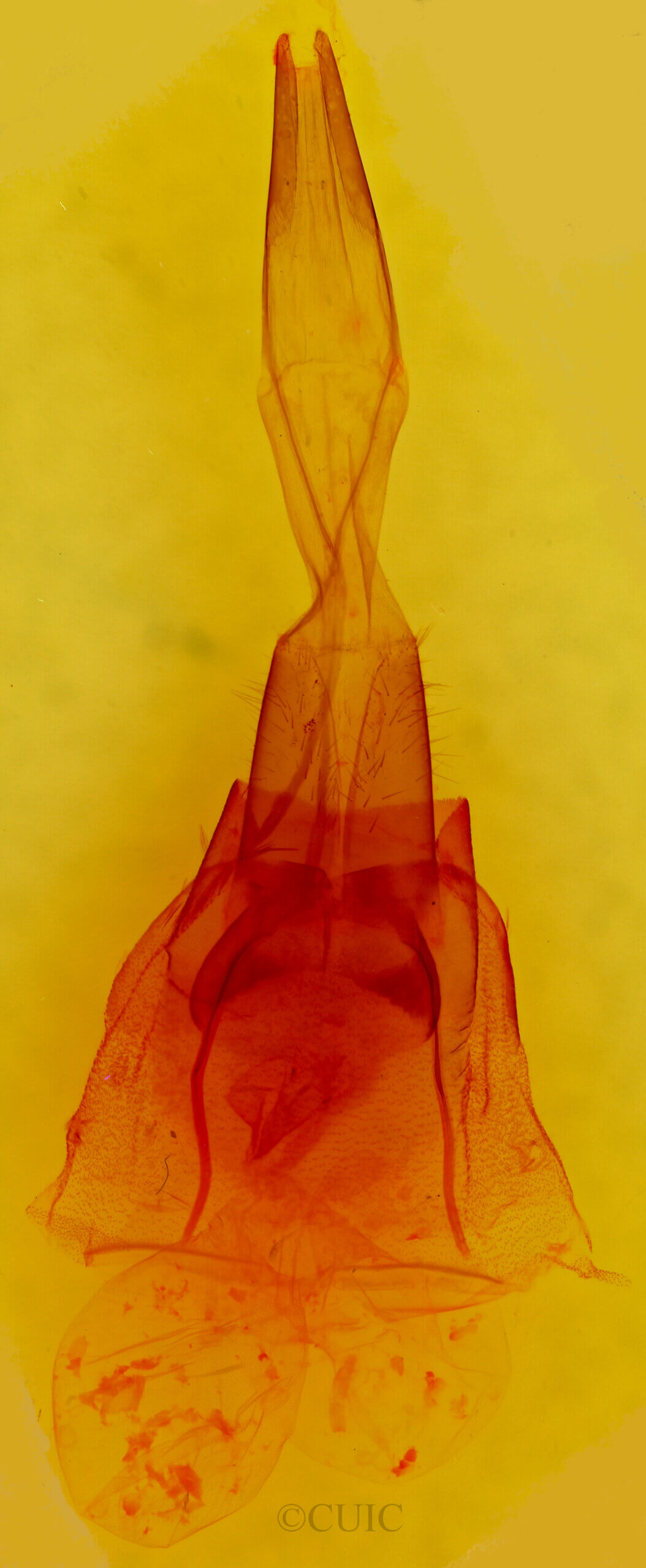 genitalia view of adult Protorthodes sp.