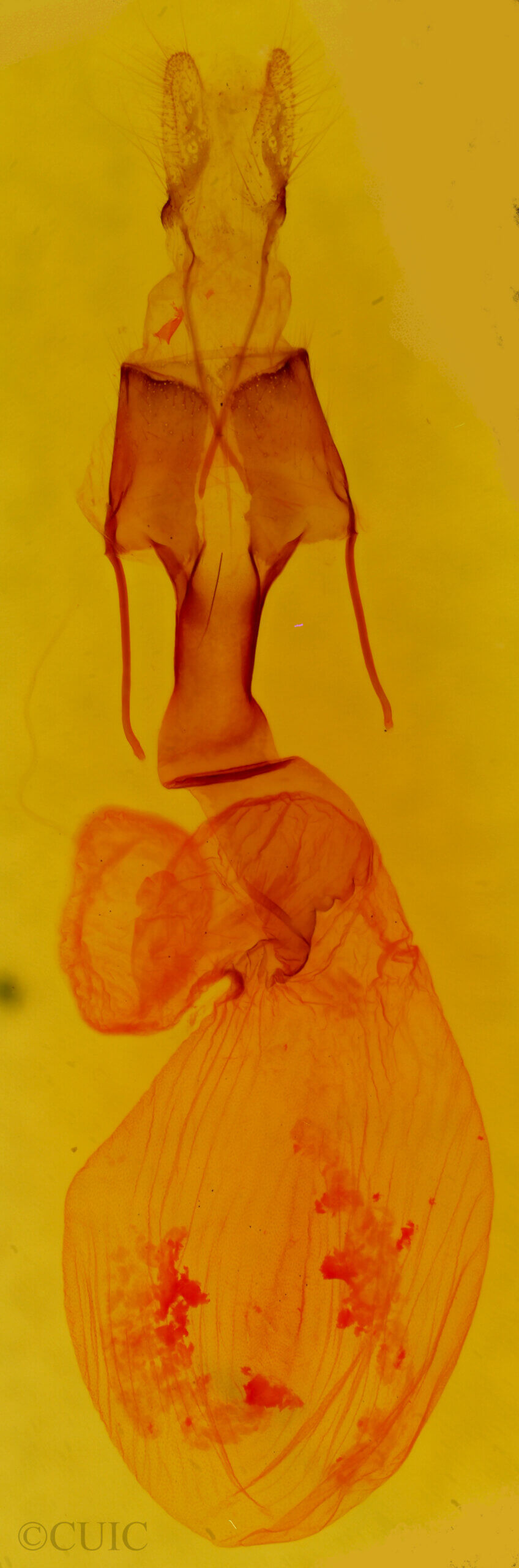 genitalia view of adult Lacinipolia sp.
