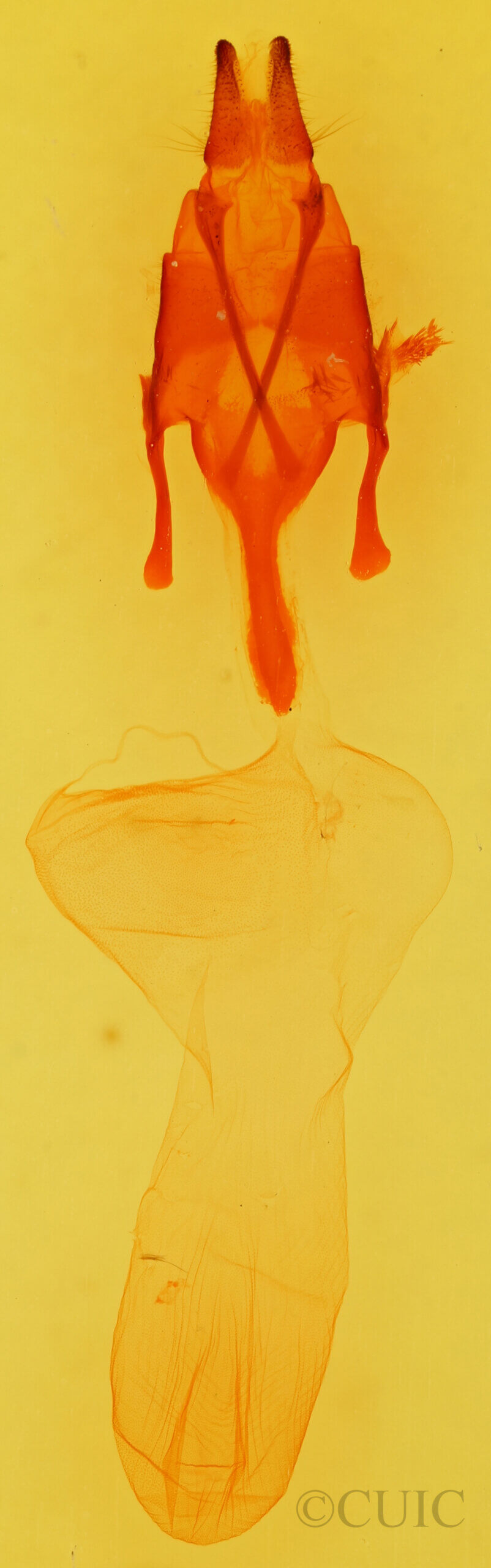 genitalia view of adult Euxoa tessellata