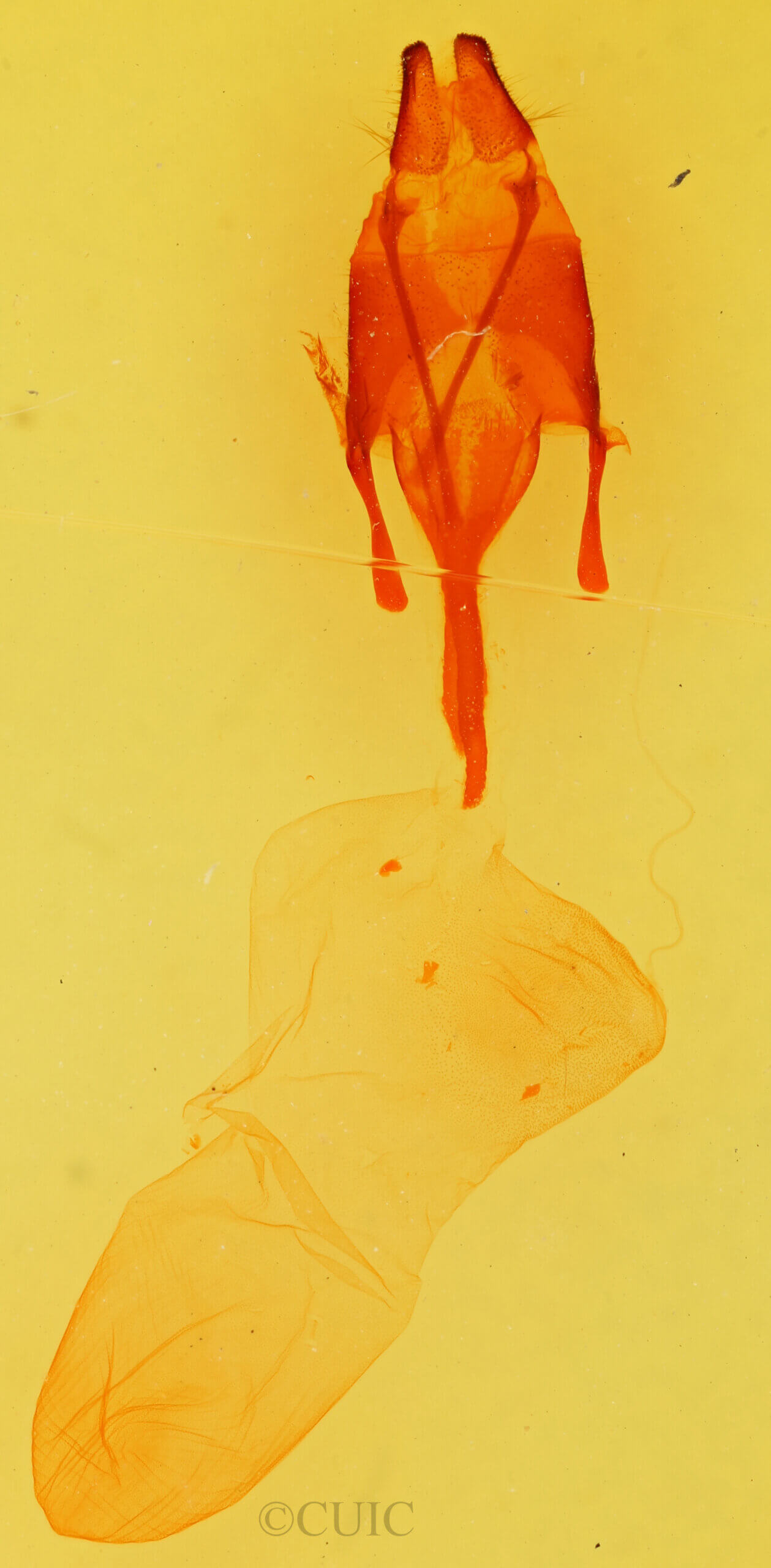 genitalia view of adult Euxoa tessellata