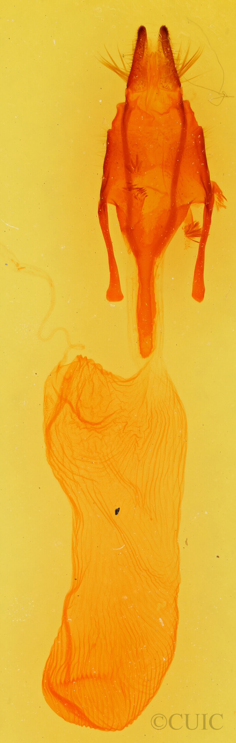 genitalia view of adult Euxoa tessellata