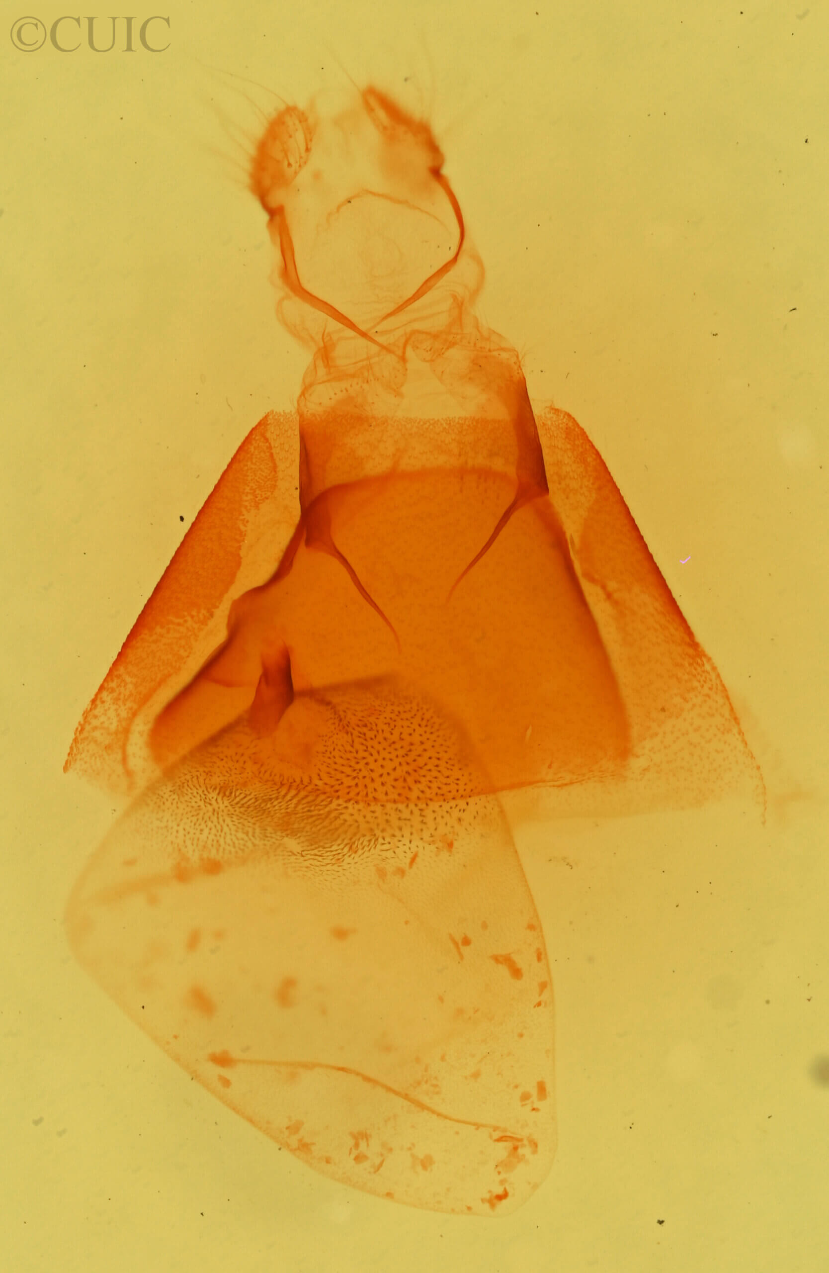 genitalia view of adult Matigramma pulverilinea