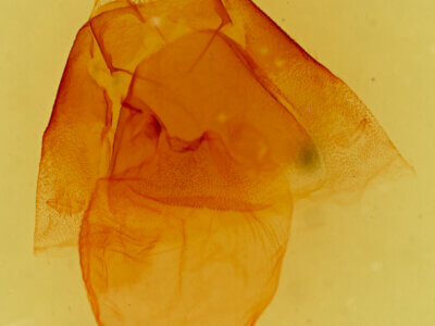 genitalia view of adult Matigramma adoceta