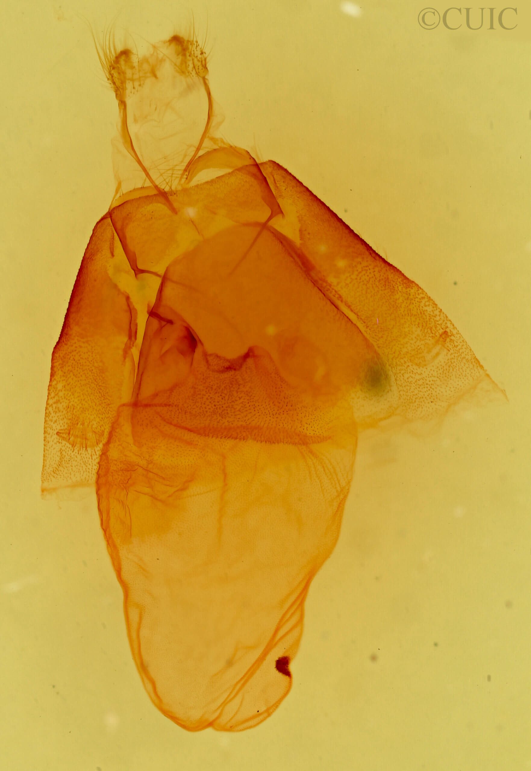 genitalia view of adult Matigramma adoceta