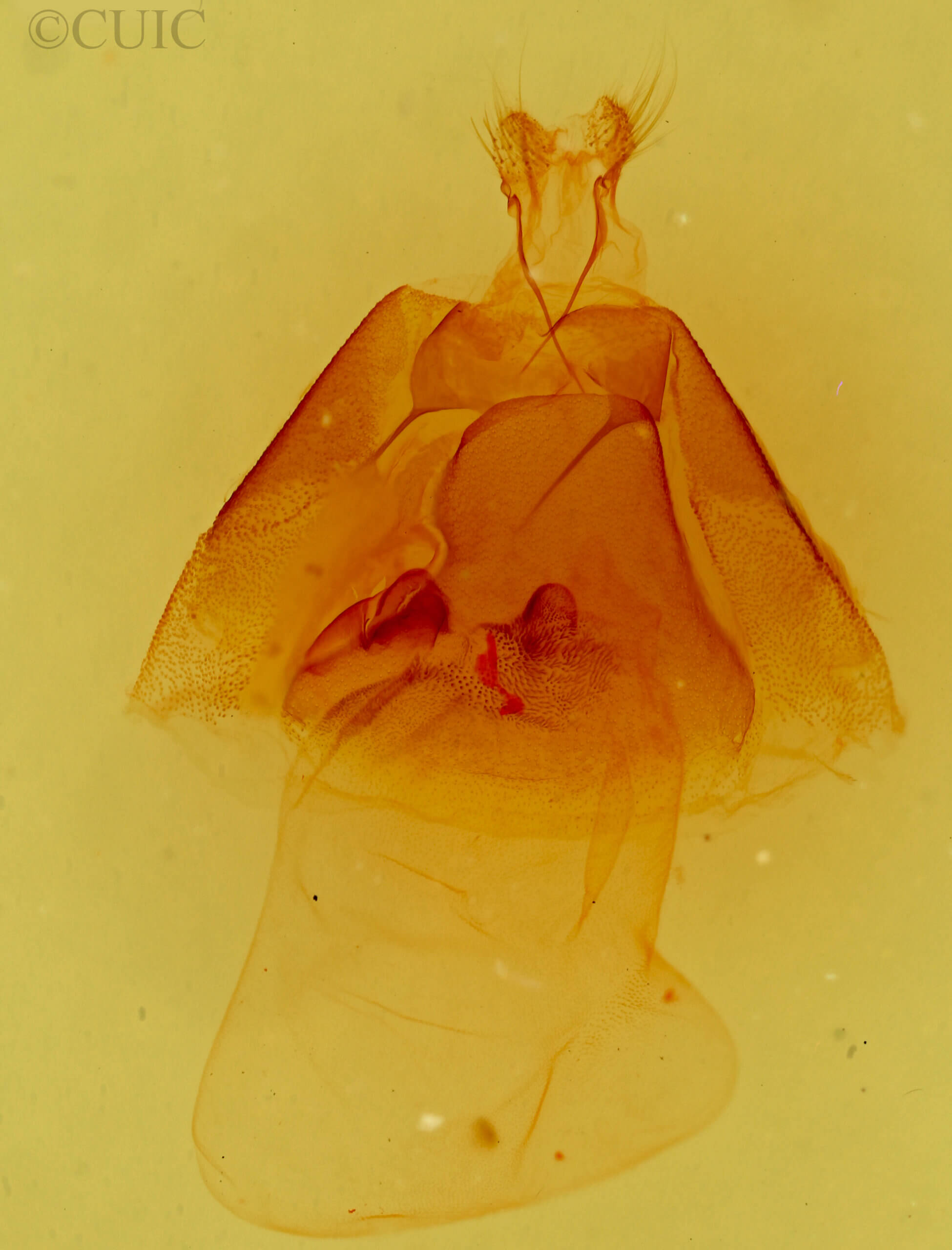 genitalia view of adult Matigramma inopinata