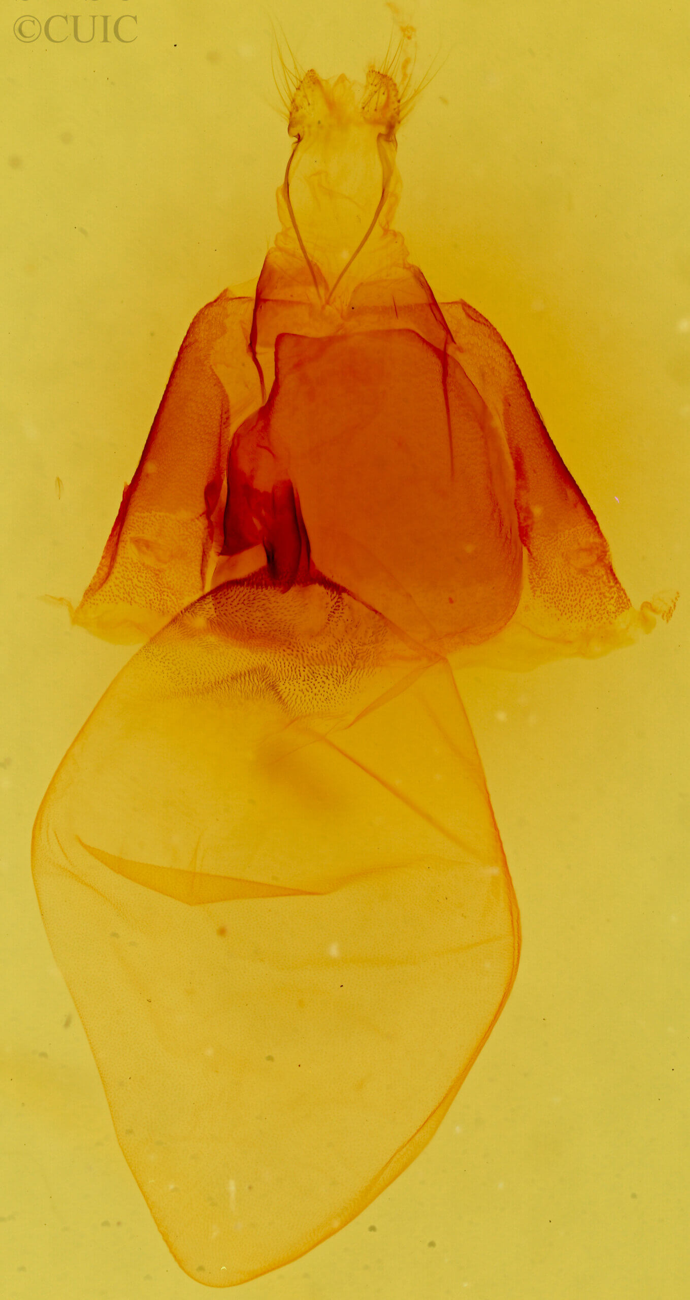 genitalia view of adult Matigramma repentina