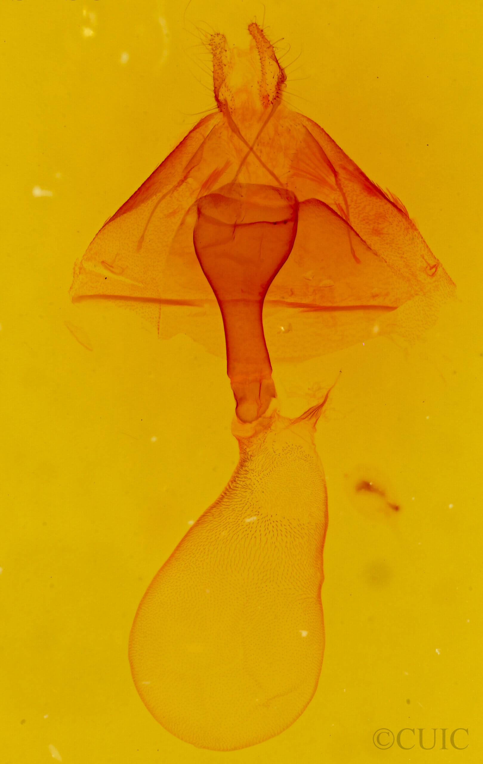 genitalia view of adult Callistege diagonalis