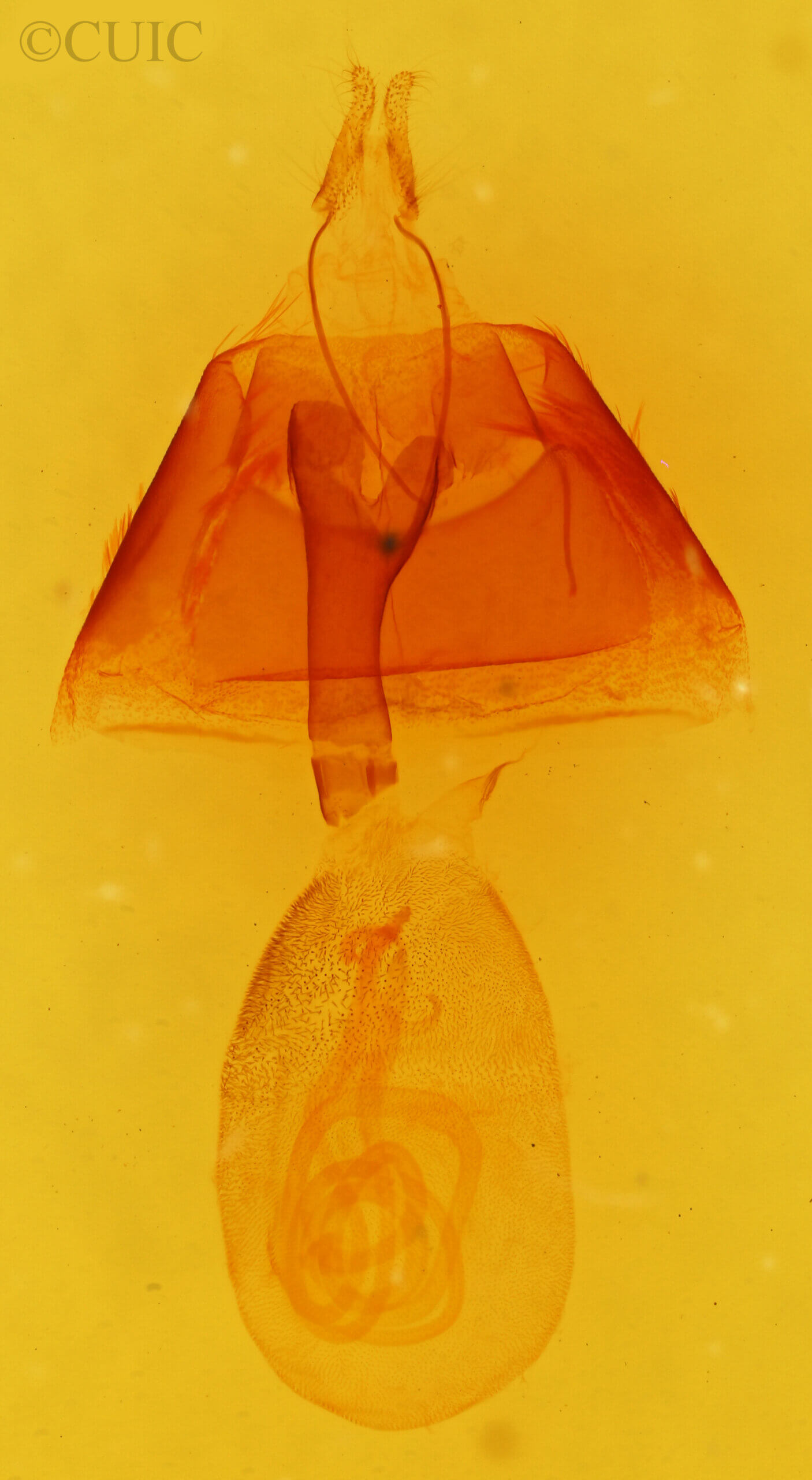 genitalia view of adult Callistege triangula