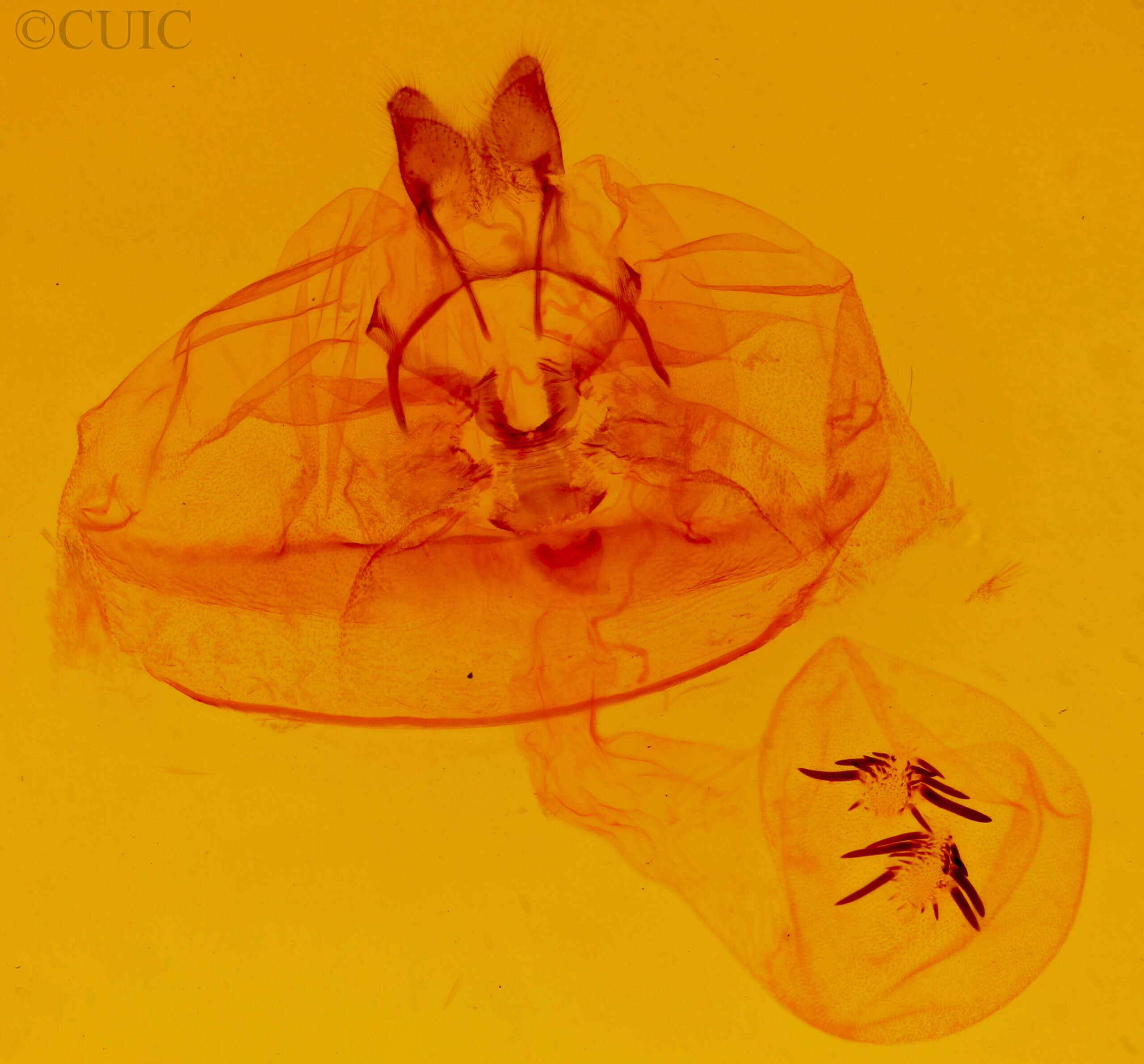 genitalia view of adult Euchaetes egle