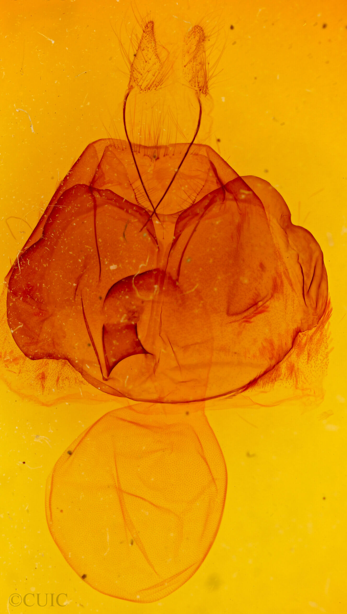 genitalia view of adult Zale n. sp. 3